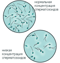 Erkaklarda bepushtlik