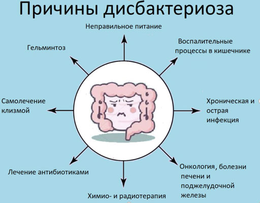 Disbakterioz sabablari