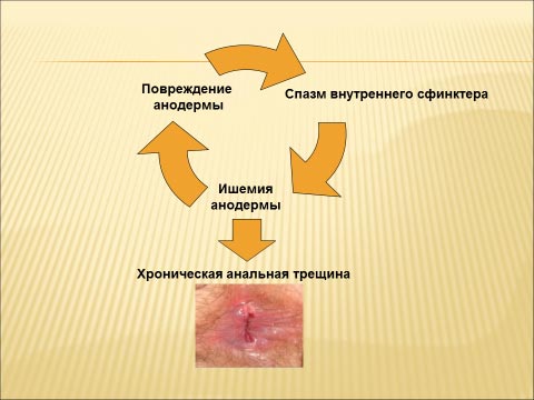 Anal yoriq sabablari